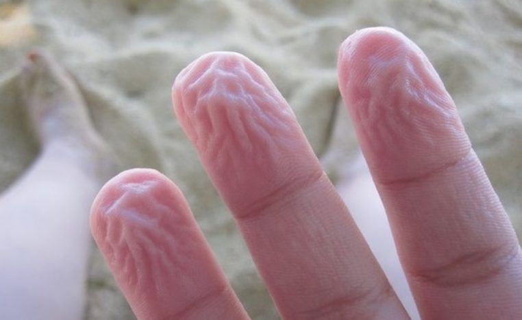 Por Que os Dedos Enrugam Quando Passamos Longo Tempo na Água? A Ciência Explica. O Fenômeno dos Dedos Enrugados: Uma Visão Geral