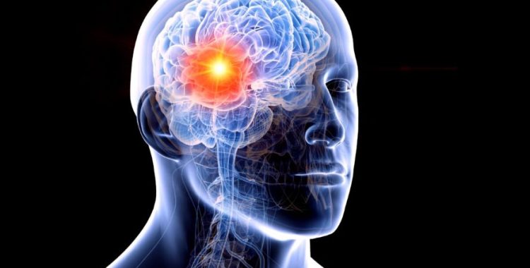 Glioma: Avanços no Combate ao Câncer Cerebral e da Medula. O que é o Glioma e por que é tão Desafiador? Acompanhe em nosso site